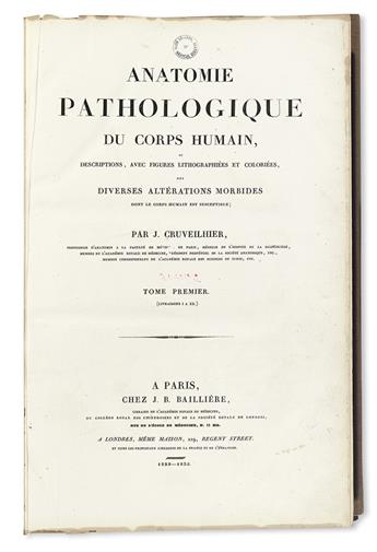 CRUVEILHIER, JEAN. Anatomie Pathologique du Corps Humain.  2 vols.  1829-42